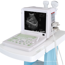 Kleine medizinische Ultraschall-Scanner-Maschine mit günstigen Preis und tragbare Ultraschallgeräte für die Schwangerschaft DW-360